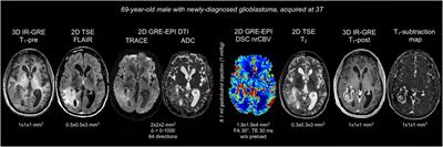 Standardized brain tumor imaging protocols for clinical trials: current recommendations and tips for integration